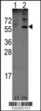 Olfactomedin 1 antibody, TA302007, Origene, Western Blot image 
