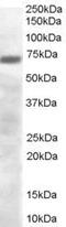 PR/SET Domain 4 antibody, PA5-18312, Invitrogen Antibodies, Western Blot image 