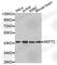 Septin 2 antibody, A3147, ABclonal Technology, Western Blot image 