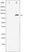 Signal Transducer And Activator Of Transcription 6 antibody, TA325907, Origene, Western Blot image 