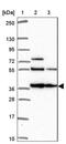 Nicotinamide Nucleotide Adenylyltransferase 1 antibody, NBP2-32464, Novus Biologicals, Western Blot image 