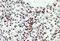 Endothelial Differentiation Related Factor 1 antibody, PA5-37908, Invitrogen Antibodies, Immunohistochemistry paraffin image 
