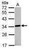 Lactamase Beta 2 antibody, PA5-32043, Invitrogen Antibodies, Western Blot image 