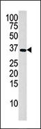 Deoxyguanosine Kinase antibody, AP13669PU-N, Origene, Western Blot image 