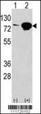 Eukaryotic Translation Initiation Factor 4B antibody, 60-584, ProSci, Western Blot image 