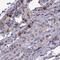 Collagen Type XXII Alpha 1 Chain antibody, NBP1-91056, Novus Biologicals, Immunohistochemistry paraffin image 