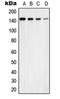 Ubiquitin Specific Peptidase 42 antibody, LS-C353581, Lifespan Biosciences, Western Blot image 