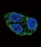 Tyrosinase antibody, PA5-14232, Invitrogen Antibodies, Immunofluorescence image 