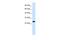 Regulator Of G Protein Signaling 13 antibody, PA5-68626, Invitrogen Antibodies, Western Blot image 