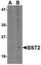 Bone Marrow Stromal Cell Antigen 2 antibody, PA5-20538, Invitrogen Antibodies, Western Blot image 