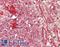 Ephrin A3 antibody, LS-B14323, Lifespan Biosciences, Immunohistochemistry paraffin image 