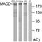 MAP Kinase Activating Death Domain antibody, LS-C119176, Lifespan Biosciences, Western Blot image 