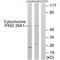 Cytochrome P450 Family 39 Subfamily A Member 1 antibody, A10436, Boster Biological Technology, Western Blot image 