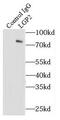 DExH-Box Helicase 58 antibody, FNab04763, FineTest, Immunoprecipitation image 