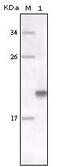 MER Proto-Oncogene, Tyrosine Kinase antibody, MA5-15358, Invitrogen Antibodies, Western Blot image 