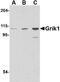 Glutamate Ionotropic Receptor Kainate Type Subunit 1 antibody, NBP1-76849, Novus Biologicals, Western Blot image 