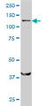 Structural Maintenance Of Chromosomes 6 antibody, LS-C133814, Lifespan Biosciences, Western Blot image 