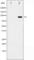 ADAM Metallopeptidase Domain 17 antibody, abx011977, Abbexa, Western Blot image 