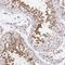 Piwi Like RNA-Mediated Gene Silencing 1 antibody, NBP2-33882, Novus Biologicals, Immunohistochemistry frozen image 
