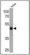 CD1a Molecule antibody, MA5-12526, Invitrogen Antibodies, Western Blot image 