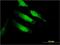Carbonic Anhydrase 10 antibody, H00056934-M01, Novus Biologicals, Immunocytochemistry image 