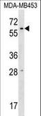 RNA Pseudouridine Synthase Domain Containing 2 antibody, LS-C158896, Lifespan Biosciences, Western Blot image 