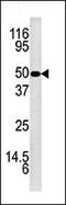 Kallikrein Related Peptidase 5 antibody, AP13372PU-N, Origene, Western Blot image 