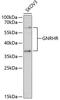 Gonadotropin Releasing Hormone Receptor antibody, 16-813, ProSci, Western Blot image 