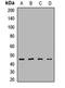 Phosphatidylinositol-5-Phosphate 4-Kinase Type 2 Alpha antibody, orb412608, Biorbyt, Western Blot image 