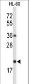 Ribonuclease H2 Subunit C antibody, LS-C162672, Lifespan Biosciences, Western Blot image 