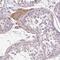 Serine Protease 38 antibody, HPA055809, Atlas Antibodies, Immunohistochemistry paraffin image 