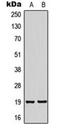 Neuronal Vesicle Trafficking Associated 2 antibody, orb224100, Biorbyt, Western Blot image 