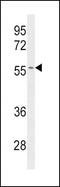 Cytochrome P450 Family 2 Subfamily C Member 19 antibody, PA5-13669, Invitrogen Antibodies, Western Blot image 