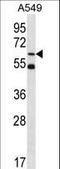 Zinc Finger Protein 248 antibody, LS-C160843, Lifespan Biosciences, Western Blot image 