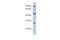 Centromere Protein I antibody, A10263, Boster Biological Technology, Western Blot image 