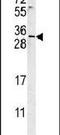 EMX2 antibody, PA5-25456, Invitrogen Antibodies, Western Blot image 