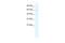 Zinc Finger Protein 224 antibody, 28-376, ProSci, Western Blot image 