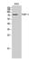 PARP2 antibody, A03270-1, Boster Biological Technology, Western Blot image 