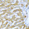 Interferon Induced Protein With Tetratricopeptide Repeats 3 antibody, 19-215, ProSci, Immunohistochemistry paraffin image 
