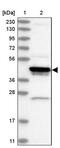 ADP Ribosylation Factor Interacting Protein 1 antibody, PA5-57923, Invitrogen Antibodies, Western Blot image 