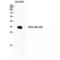 FcRII antibody, LS-C382541, Lifespan Biosciences, Western Blot image 