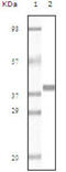 Myoglobin antibody, abx011221, Abbexa, Enzyme Linked Immunosorbent Assay image 