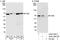 TGF-Beta Activated Kinase 1 (MAP3K7) Binding Protein 1 antibody, A302-165A, Bethyl Labs, Western Blot image 