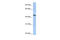 Zinc Finger Protein 766 antibody, 26-519, ProSci, Enzyme Linked Immunosorbent Assay image 