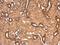 Protein Phosphatase 2 Scaffold Subunit Aalpha antibody, GTX102206, GeneTex, Immunohistochemistry paraffin image 