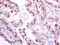 NIMA Related Kinase 2 antibody, PA5-31259, Invitrogen Antibodies, Immunohistochemistry paraffin image 