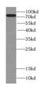 Transmembrane Protein 181 antibody, FNab08763, FineTest, Western Blot image 