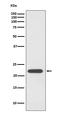 Peroxiredoxin 1 antibody, M01845, Boster Biological Technology, Western Blot image 