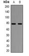 Nuclear Factor Of Activated T Cells 1 antibody, orb381911, Biorbyt, Western Blot image 