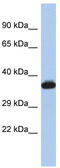 GTPase, IMAP Family Member 2 antibody, TA335586, Origene, Western Blot image 